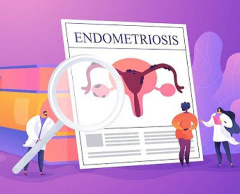 آندومتریوز چیست؟