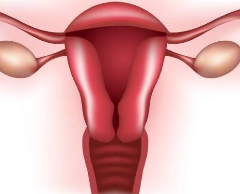 علت خونریزی شدید در قاعدگی