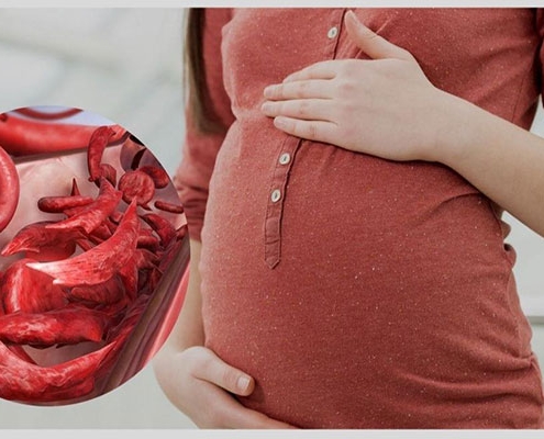 علائم کم خونی