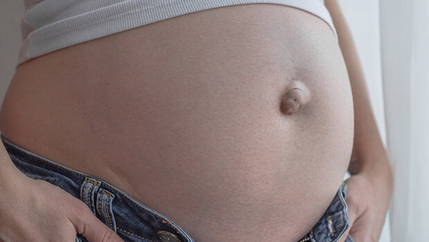جلوگیری از فتق ناف در بارداری